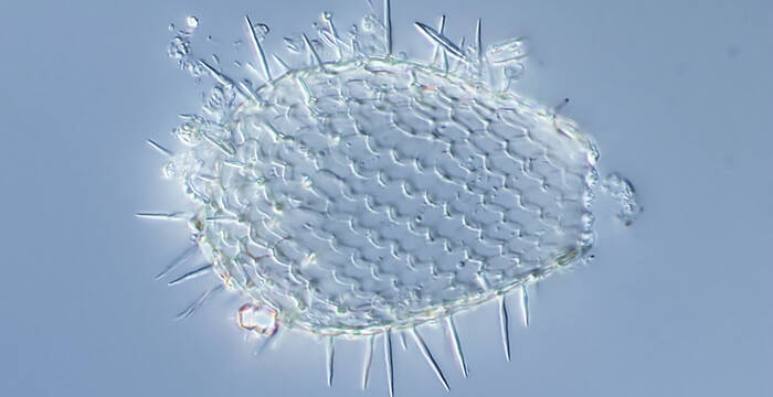 Leere Schale von Euglypha sp. Sie besteht aus Siliziumoxid, dem gleichen Material wie Glas. Bei der Zellteilung entsteht eine neue Amöbe mit einer Schale, die mit der ihres «Elternteils» identisch ist.