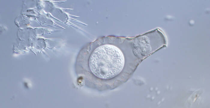 Diese Hyalophenia elegans hat eine feste Zyste gebildet, um schwierige Zeiten wie Dürren zu überstehen. Die Amöbe ist die Kugel in der Mitte der Schale. Vor der Encystierung hat sie die Öffnung der Schale verpfropft, um vor Feinden geschützt zu sein.