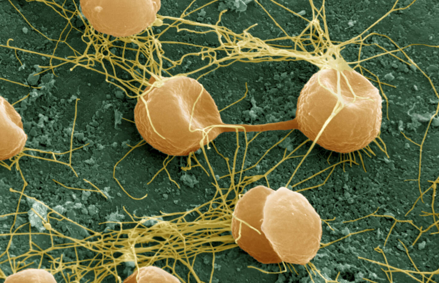 Mikroskopische Aufnahme von Pyrococcus furiosus archaea